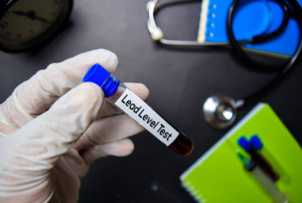 Gloved hand holding a blood sample tube labeled Lead Level Test